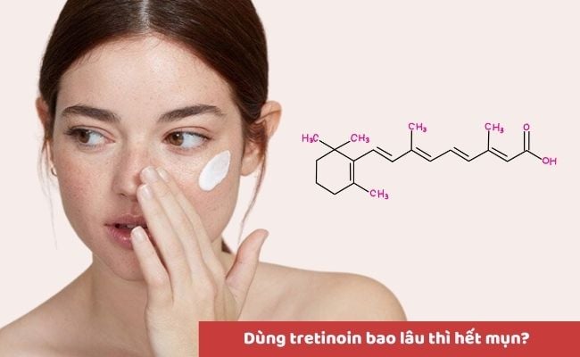 Một số câu hỏi liên quan đến Tretinoin