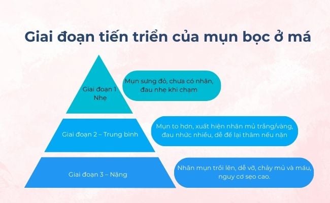 Giai đoạn tiến triển của mụn bọc ở má