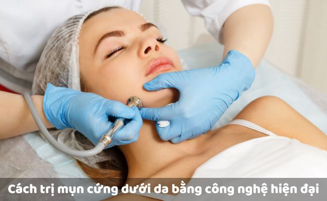 Cách trị mụn cứng dưới da bằng công nghệ hiện đại

