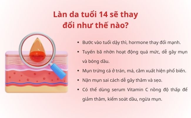 Làn da tuổi 14 sẽ thay đổi như thế nào?
