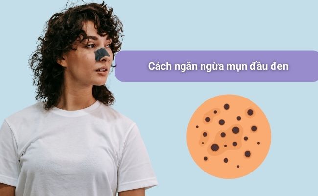 Cách ngăn ngừa mụn đầu đen