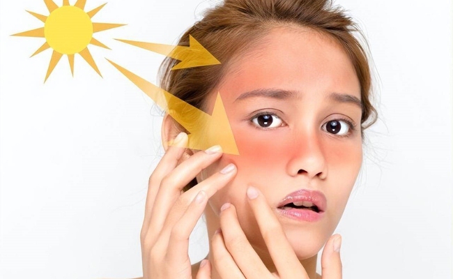 Chỉ số tia UV bao nhiêu là nguy hiểm