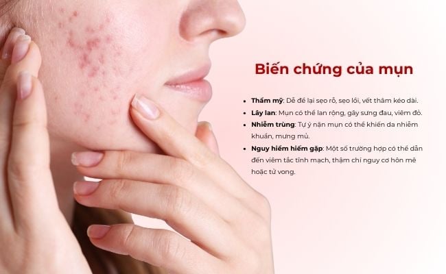 Biến chứng của mụn

