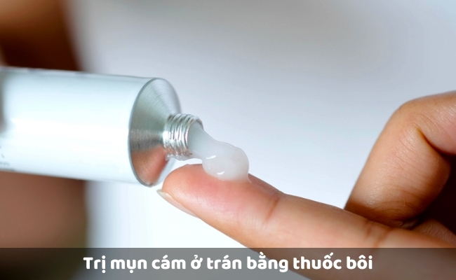 Trị mụn cám ở trán bằng thuốc bôi