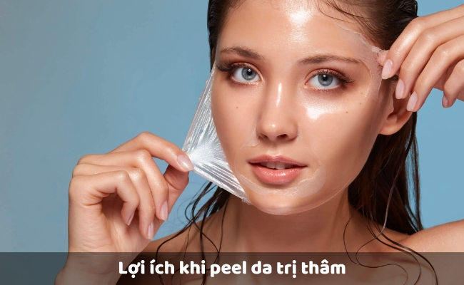 Lợi ích khi peel da trị thâm