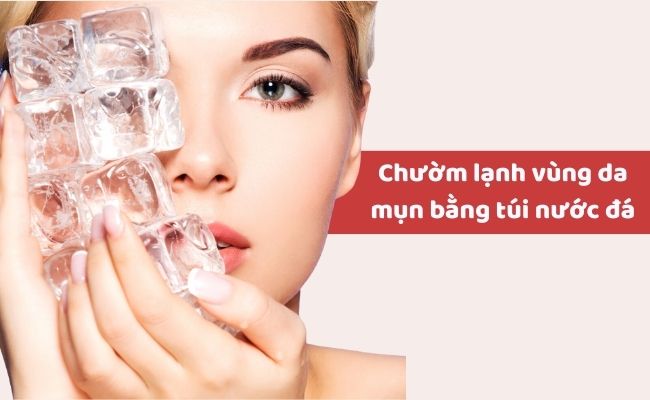 Cách điều trị mụn bọc ở cằm tại nhà?
