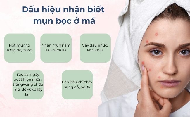 Dấu hiệu nhận biết mụn bọc ở má