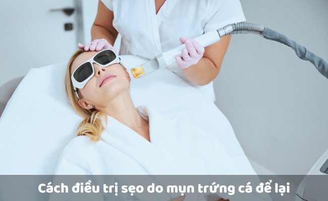 Cách điều trị sẹo do mụn trứng cá để lại