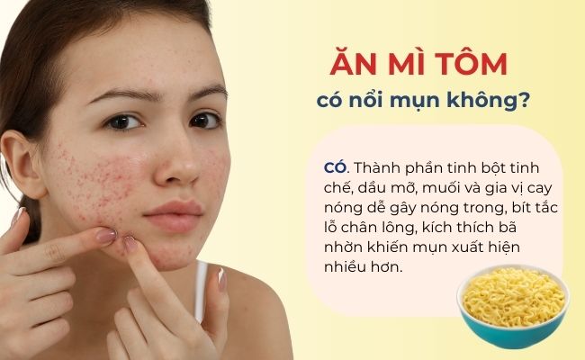 Ăn mì tôm có nổi mụn không?