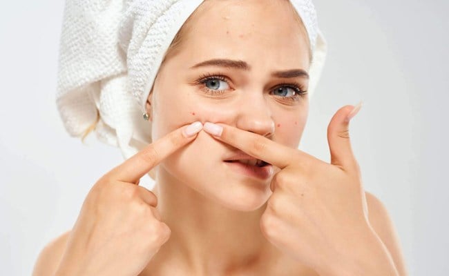 Các loại mụn trứng cá phổ biến