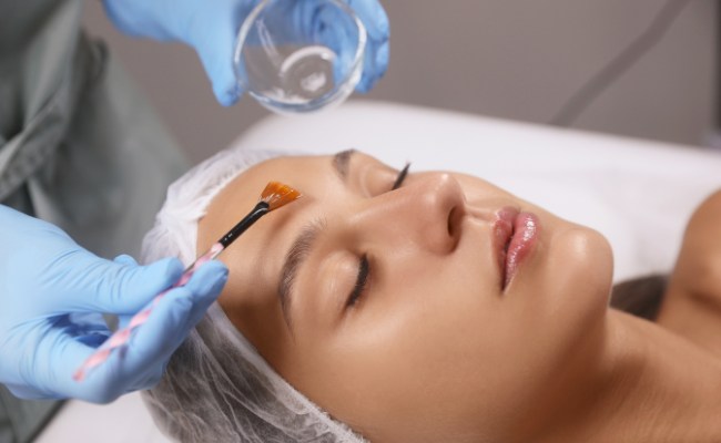 Peel da trị mụn bọc
