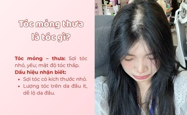 Đặc điểm tóc mỏng thưa