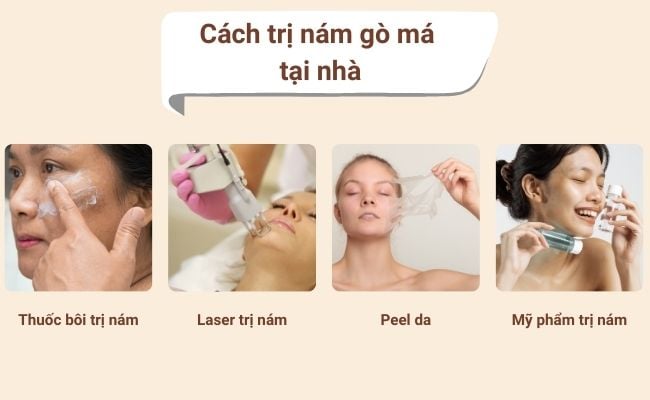 Cách trị nám gò má tại nhà