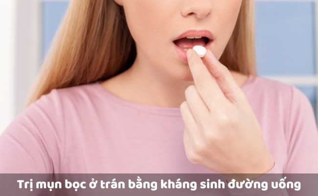 Kháng sinh đường uống - Cách điều trị mụn bọc ở trán bằng liệu pháp y tế

