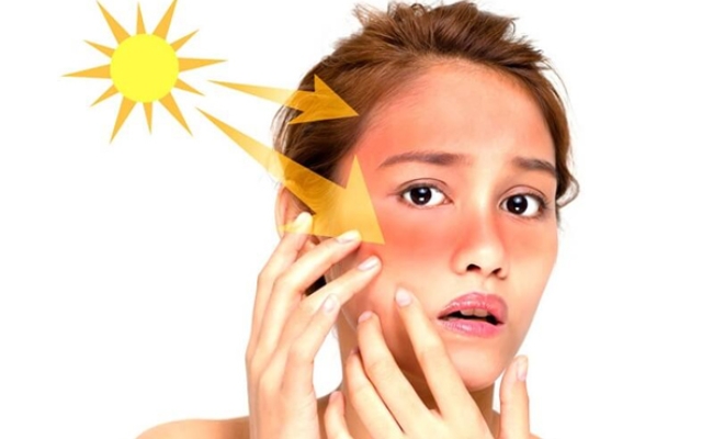 Tác dụng của Vitamin C giúp da khỏi tác hại của tia UV
