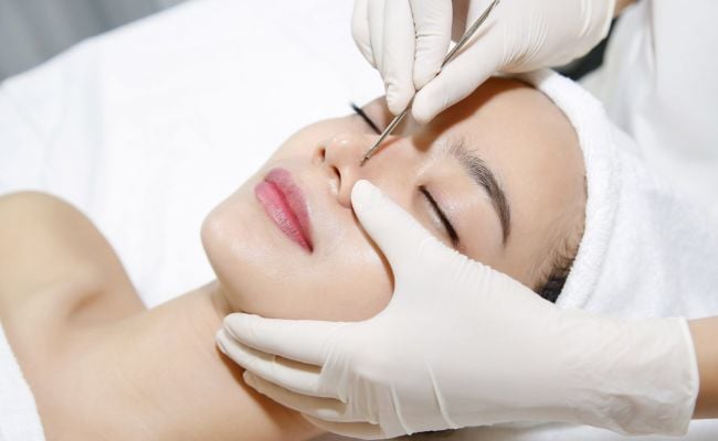 Có nên nặn mụn không nhân viêm đỏ không?