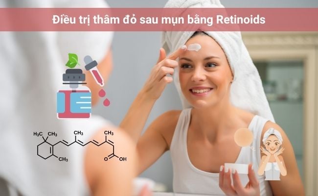 Retinoids - Cách trị thâm đỏ 2 bên má sau mụn

