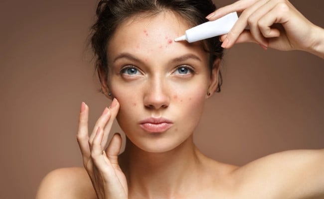 Dùng BHA bị đẩy mụn phải làm sao?