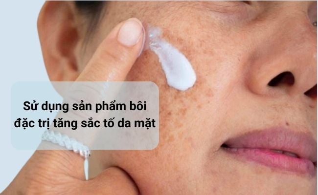 Bôi thuốc đặc trị để cải thiện tình trạng tăng sắc tố trên da mặt