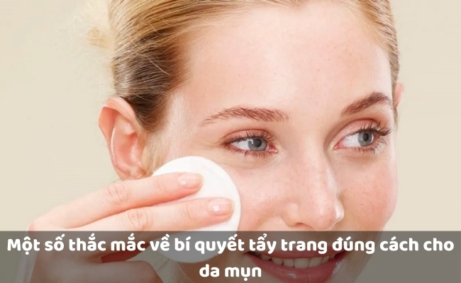Một số thắc mắc về bí quyết tẩy trang đúng cách cho da mụn
