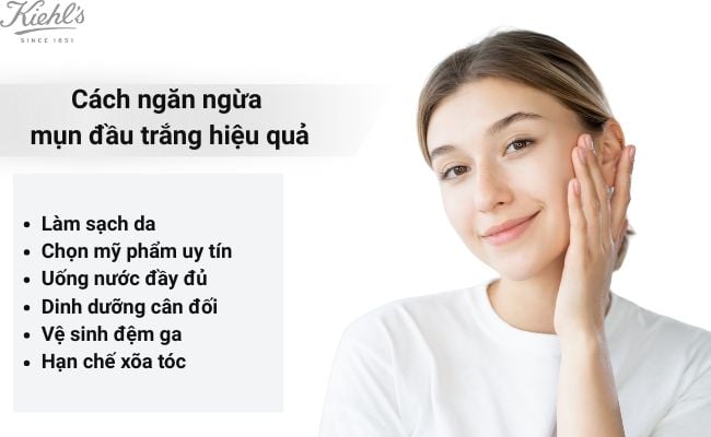 Cách ngăn ngừa mụn đầu trắng hiệu quả