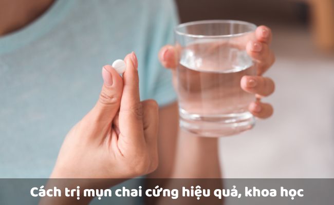Sử dụng thuốc uống
 
  