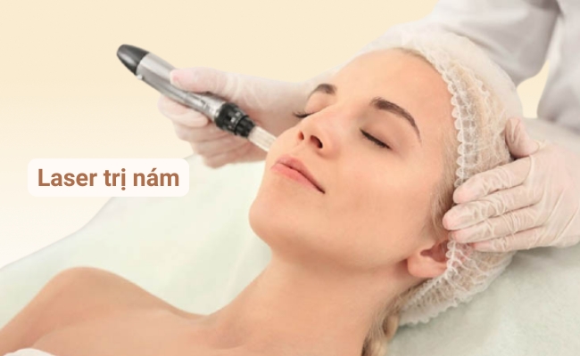 Laser điều trị nám trên da hiệu quả nhanh chóng