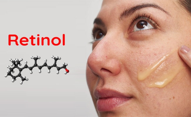 Sử dụng kem trị mụn cám chứa Retinoids