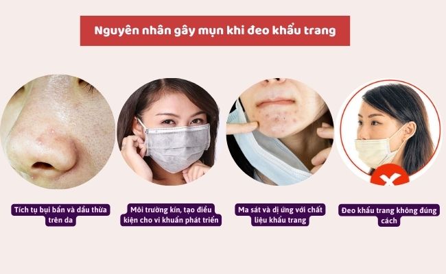 Nguyên nhân gây mụn khi đeo khẩu trang