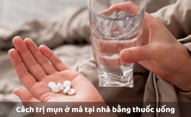 Cách trị mụn ở má tại nhà bằng thuốc uống

