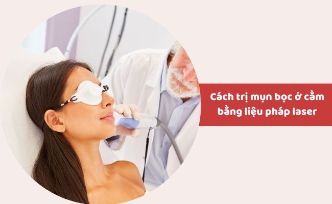 Trị mụn bọc ở cằm bằng liệu pháp y tế