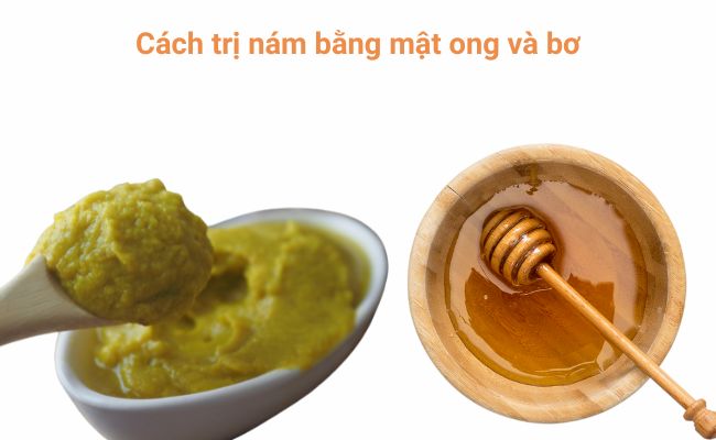 Cách trị nám bằng mật ong và bơ