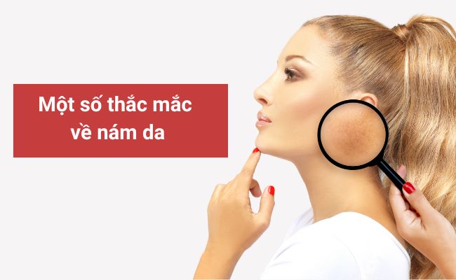 Một số thắc mắc về nám da
