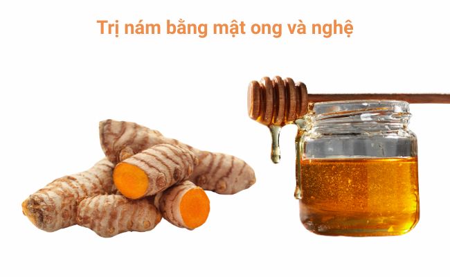 Trị nám bằng mật ong và nghệ