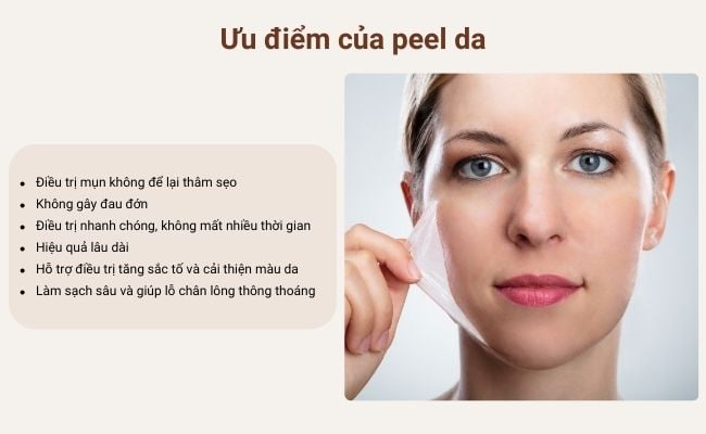 Ưu điểm phương pháp làm đẹp peel da