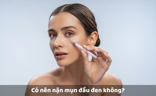 Có nên nặn mụn đầu đen không?