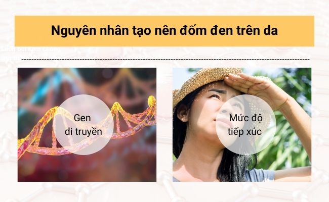 Cách phòng ngừa tình trạng rối loạn sắc tố da