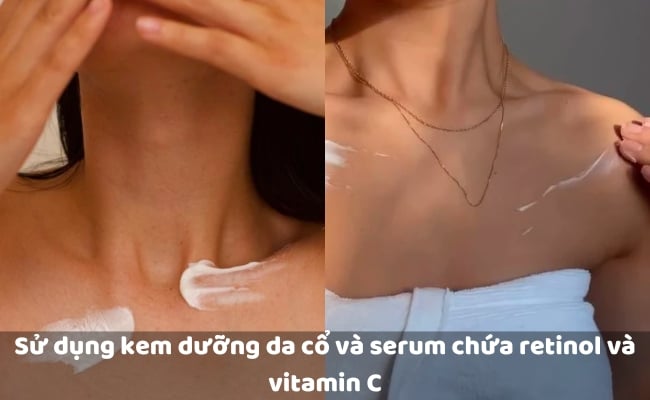 Cách xóa nếp nhăn ở cổ an toàn, đơn giản, hiệu quả nhất