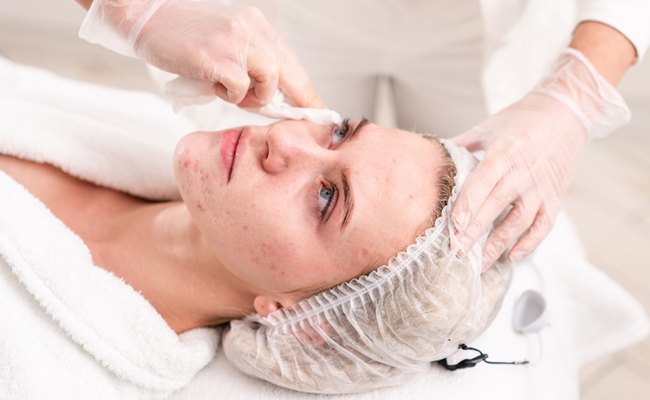 Điều trị mụn bằng liệu pháp công nghệ cao