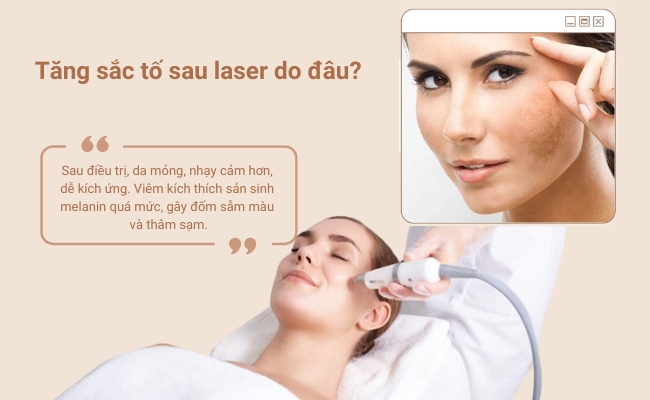 Làn da trở nên sậm màu sau khi bắn laser