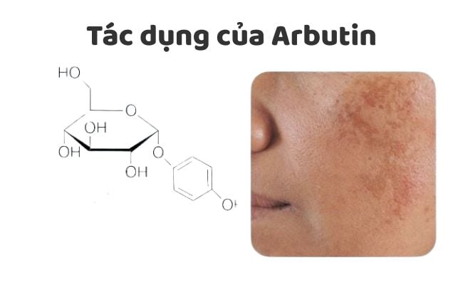Công dụng của Alpha Arbutin