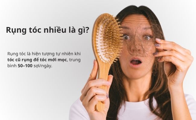 Rụng tóc nhiều là gì?