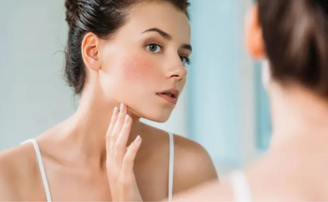 Retinol có thể khiến da bị bong tróc Retinol có thể khiến da bị bong tróc