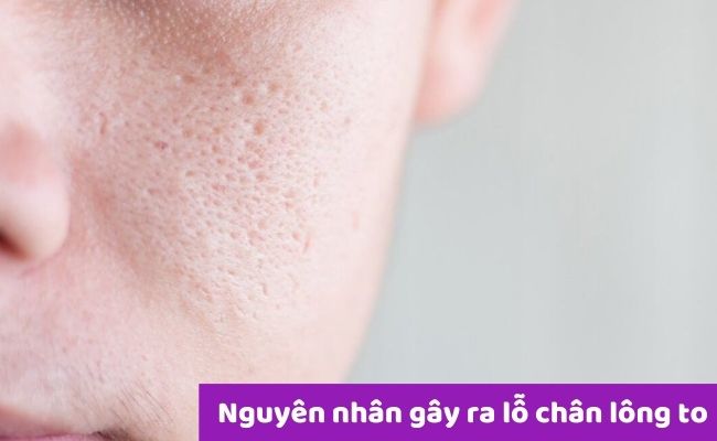 ”Nguyên