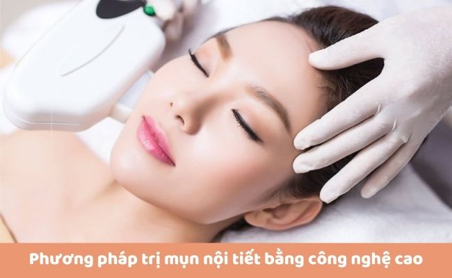 Cách trị mụn nội tiết dứt điểm, an toàn, nhanh chóngt