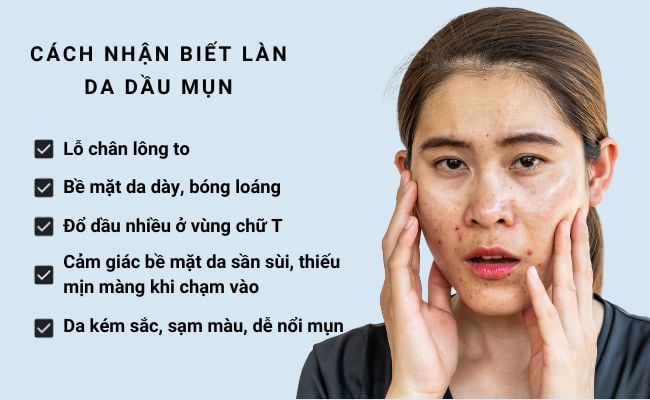 Da dầu mụn là gì