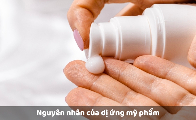 Nguyên nhân của dị ứng mỹ phẩm