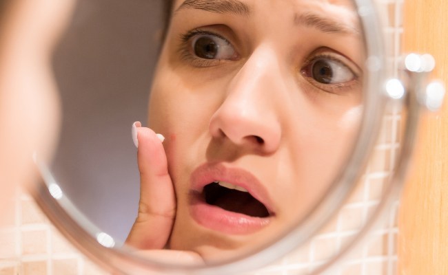 Cách trị mụn bọc sưng đỏ tại nhà hiệu quả bằng Isotretinoin