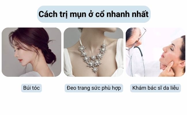 Các cách trên giúp da cổ thông thoáng hơn mà còn hỗ trợ quá trình điều trị mụn đạt hiệu quả tốt hơn.
