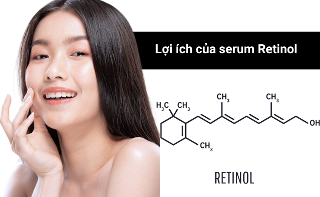 Serum Retinol có tác dụng giúp hỗ trợ điều trị mụn Serum Retinol có tác dụng giúp hỗ trợ điều trị mụn